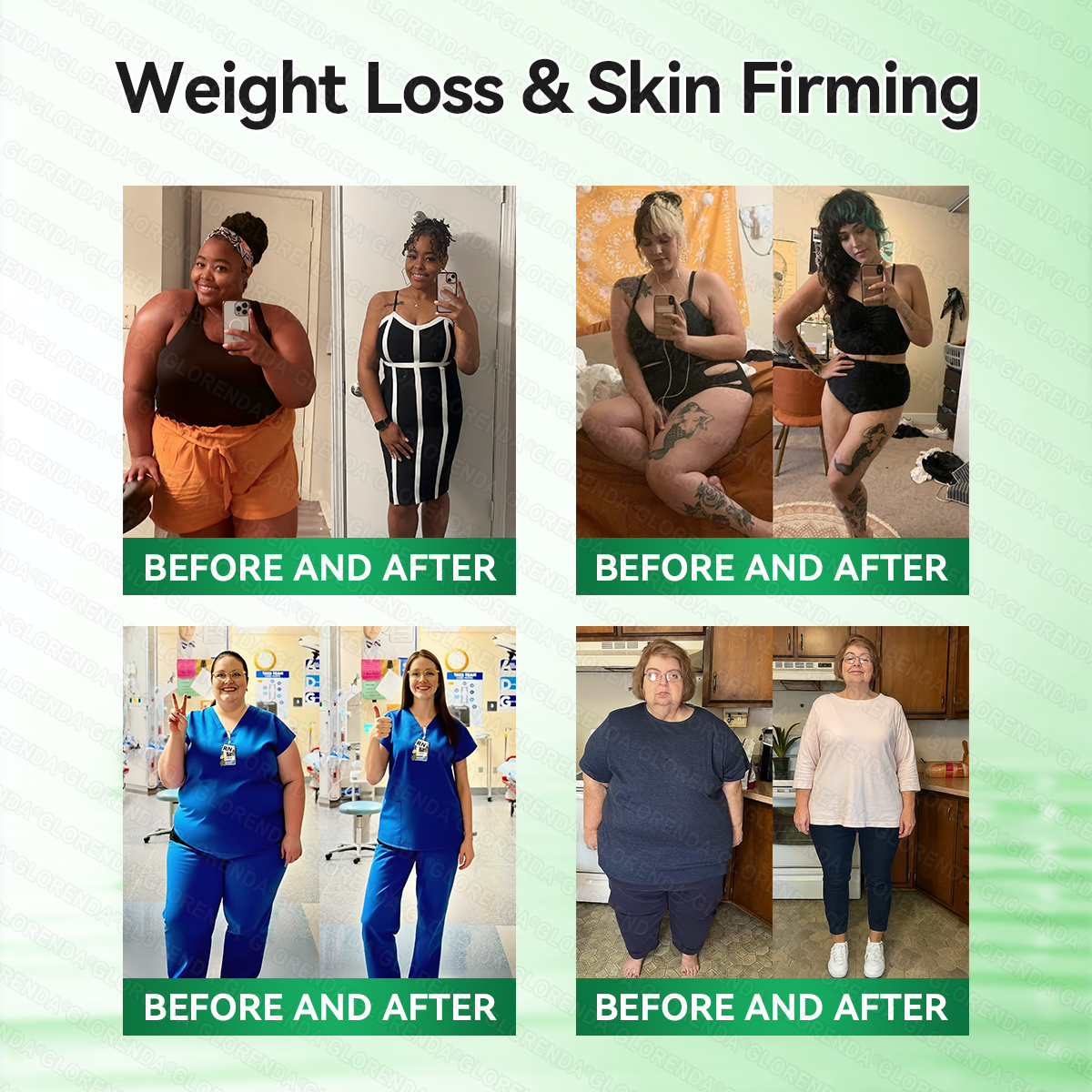 𝐆𝐋𝐎𝑹𝑬𝑵𝑫𝗔®𝑴𝒐𝒓𝒊𝒏𝒈𝗮 · 𝗕𝗲𝗿𝗯𝗲𝗿𝙞𝙣𝙚 × 𝙉𝘼𝐃+ 𝟏𝟎-𝐢𝐧-𝟏 𝗔𝗱𝘃𝗮𝗻𝗰𝙚𝙙 𝙉𝙖𝙣𝙤 𝙈𝙞𝙘𝙧𝙤𝙣𝙚𝙚𝐝𝐥𝐞 𝐏𝐚𝐭𝙘𝙝(𝐉𝐮𝐬𝐭 𝐨𝐧𝐜𝐞 𝐚 𝐝𝐚𝐲, 𝐯𝐢𝐬𝐢𝐛𝐥𝐞 𝐜𝐡𝐚𝐧𝐠𝐞𝐬 𝐢𝐧 𝟕 𝐝𝐚𝐲𝐬）🏆𝐅𝐨𝐫 𝐨𝐛𝐞𝐬𝐢𝐭𝐲, 𝐋𝐎𝐎𝐒𝐄 𝐒𝐊𝐈𝐍,𝐝𝐢𝐚𝐛𝐞𝐭𝐞𝐬, 𝐬𝐥𝐞𝐞𝐩 𝐚𝐩𝐧𝐞𝐚, 𝐣𝐨𝐢𝐧𝐭 𝐢𝐬𝐬𝐮𝐞𝐬, 𝐚𝐧𝐝 𝐦𝐨𝐫𝐞🏆