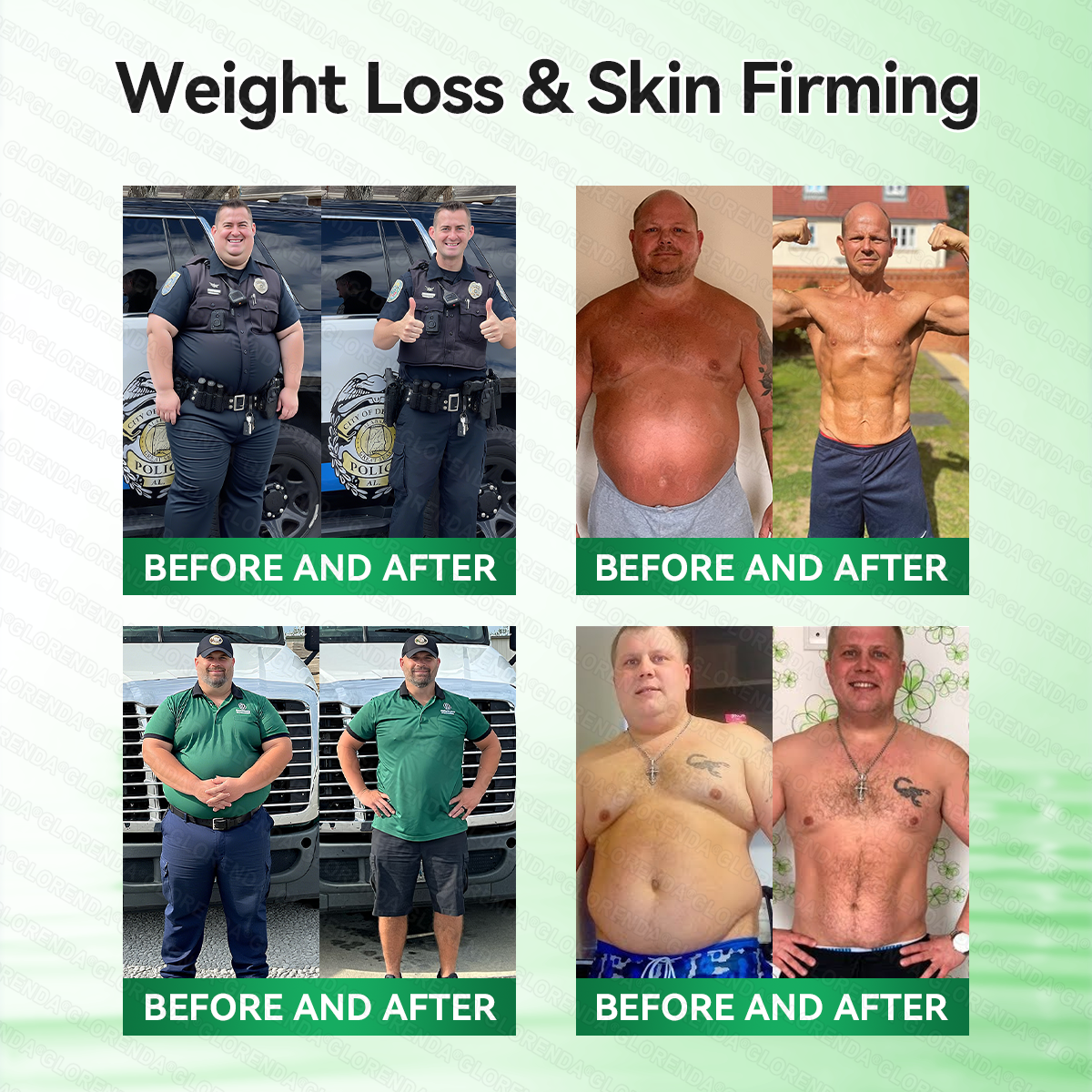 𝐆𝐋𝐎𝑹𝑬𝑵𝑫𝗔®𝑴𝒐𝒓𝒊𝒏𝒈𝗮 · 𝗕𝗲𝗿𝗯𝗲𝗿𝙞𝙣𝙚 × 𝙉𝘼𝐃+ 𝟏𝟎-𝐢𝐧-𝟏 𝗔𝗱𝘃𝗮𝗻𝗰𝙚𝙙 𝙉𝙖𝙣𝙤 𝙈𝙞𝙘𝙧𝙤𝙣𝙚𝙚𝐝𝐥𝐞 𝐏𝐚𝐭𝙘𝙝(𝐉𝐮𝐬𝐭 𝐨𝐧𝐜𝐞 𝐚 𝐝𝐚𝐲, 𝐯𝐢𝐬𝐢𝐛𝐥𝐞 𝐜𝐡𝐚𝐧𝐠𝐞𝐬 𝐢𝐧 𝟕 𝐝𝐚𝐲𝐬）🏆𝐅𝐨𝐫 𝐨𝐛𝐞𝐬𝐢𝐭𝐲, 𝐋𝐎𝐎𝐒𝐄 𝐒𝐊𝐈𝐍,𝐝𝐢𝐚𝐛𝐞𝐭𝐞𝐬, 𝐬𝐥𝐞𝐞𝐩 𝐚𝐩𝐧𝐞𝐚, 𝐣𝐨𝐢𝐧𝐭 𝐢𝐬𝐬𝐮𝐞𝐬, 𝐚𝐧𝐝 𝐦𝐨𝐫𝐞🏆