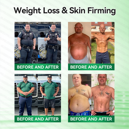 𝐆𝐋𝐎𝑹𝑬𝑵𝑫𝗔®𝑴𝒐𝒓𝒊𝒏𝒈𝗮 · 𝗕𝗲𝗿𝗯𝗲𝗿𝙞𝙣𝙚 × 𝙉𝘼𝐃+ 𝟏𝟎-𝐢𝐧-𝟏 𝗔𝗱𝘃𝗮𝗻𝗰𝙚𝙙 𝙉𝙖𝙣𝙤 𝙈𝙞𝙘𝙧𝙤𝙣𝙚𝙚𝐝𝐥𝐞 𝐏𝐚𝐭𝙘𝙝(𝐉𝐮𝐬𝐭 𝐨𝐧𝐜𝐞 𝐚 𝐝𝐚𝐲, 𝐯𝐢𝐬𝐢𝐛𝐥𝐞 𝐜𝐡𝐚𝐧𝐠𝐞𝐬 𝐢𝐧 𝟕 𝐝𝐚𝐲𝐬）🏆𝐅𝐨𝐫 𝐨𝐛𝐞𝐬𝐢𝐭𝐲, 𝐋𝐎𝐎𝐒𝐄 𝐒𝐊𝐈𝐍,𝐝𝐢𝐚𝐛𝐞𝐭𝐞𝐬, 𝐬𝐥𝐞𝐞𝐩 𝐚𝐩𝐧𝐞𝐚, 𝐣𝐨𝐢𝐧𝐭 𝐢𝐬𝐬𝐮𝐞𝐬, 𝐚𝐧𝐝 𝐦𝐨𝐫𝐞🏆